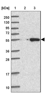 CABYR Antibody in Western Blot (WB)