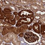 SMCO3 Polyclonal Antibody