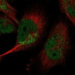 LIN37 Polyclonal Antibody