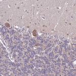 LIN37 Antibody in Immunohistochemistry (Paraffin) (IHC (P))