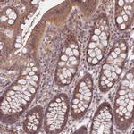 LIN37 Antibody in Immunohistochemistry (Paraffin) (IHC (P))