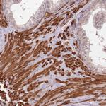 LIN37 Antibody in Immunohistochemistry (Paraffin) (IHC (P))