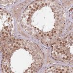 LIN37 Antibody in Immunohistochemistry (Paraffin) (IHC (P))