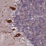 ZC3HAV1 Antibody in Immunohistochemistry (Paraffin) (IHC (P))