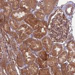 ZC3HAV1 Antibody in Immunohistochemistry (Paraffin) (IHC (P))