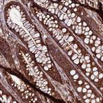 ZC3HAV1 Antibody in Immunohistochemistry (Paraffin) (IHC (P))