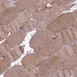 ZC3HAV1 Antibody in Immunohistochemistry (Paraffin) (IHC (P))
