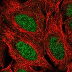 PPP1R17 Polyclonal Antibody