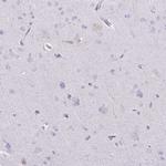 COLGALT1 Antibody in Immunohistochemistry (Paraffin) (IHC (P))