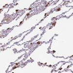 COLGALT1 Antibody in Immunohistochemistry (Paraffin) (IHC (P))