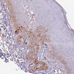 COLGALT1 Antibody in Immunohistochemistry (Paraffin) (IHC (P))