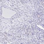 ENOSF1 Antibody in Immunohistochemistry (IHC)