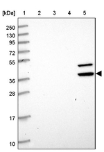 ENOSF1 Antibody in Western Blot (WB)
