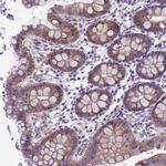KIAA1407 Antibody in Immunohistochemistry (Paraffin) (IHC (P))