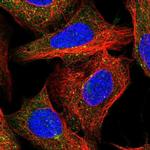 FAM21A Polyclonal Antibody