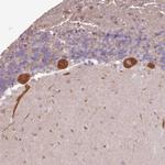 FAM21A Antibody in Immunohistochemistry (Paraffin) (IHC (P))