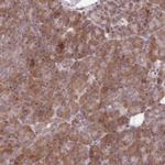 FAM21A Antibody in Immunohistochemistry (Paraffin) (IHC (P))