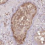 FAM21A Antibody in Immunohistochemistry (Paraffin) (IHC (P))