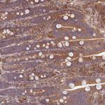 FAM21A Antibody in Immunohistochemistry (IHC)