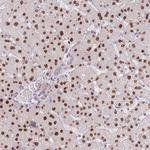 ZNF439 Polyclonal Antibody