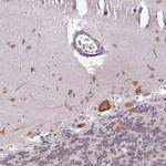 RBM4B Antibody in Immunohistochemistry (Paraffin) (IHC (P))