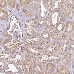 RBM4B Antibody in Immunohistochemistry (Paraffin) (IHC (P))
