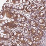 RBM4B Antibody in Immunohistochemistry (Paraffin) (IHC (P))