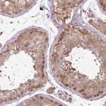 RBM4B Antibody in Immunohistochemistry (Paraffin) (IHC (P))