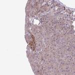 CCDC144A Polyclonal Antibody