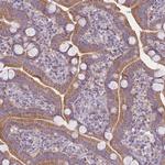 PDHA2 Antibody in Immunohistochemistry (Paraffin) (IHC (P))