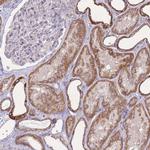 PDHA2 Antibody in Immunohistochemistry (Paraffin) (IHC (P))