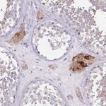 PDHA2 Antibody in Immunohistochemistry (Paraffin) (IHC (P))