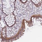 PRAC Antibody in Immunohistochemistry (Paraffin) (IHC (P))
