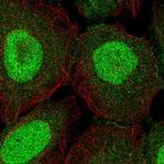 ZNF497 Polyclonal Antibody