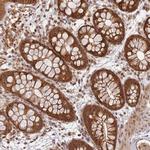 ZNF497 Antibody in Immunohistochemistry (Paraffin) (IHC (P))