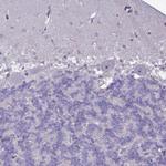 SLC15A3 Polyclonal Antibody