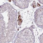 SLC15A3 Antibody in Immunohistochemistry (Paraffin) (IHC (P))