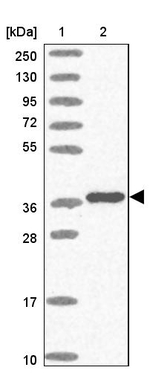 TBX10 Antibody in Western Blot (WB)