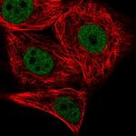 PATZ1 Polyclonal Antibody