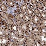 PATZ1 Antibody in Immunohistochemistry (Paraffin) (IHC (P))