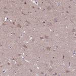 RASD1 Antibody in Immunohistochemistry (Paraffin) (IHC (P))