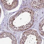 RASD1 Antibody in Immunohistochemistry (Paraffin) (IHC (P))