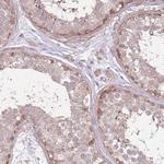 SPATA31D1 Antibody in Immunohistochemistry (Paraffin) (IHC (P))