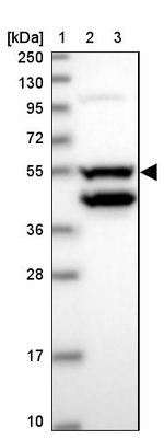 CCDC149 Antibody in Western Blot (WB)