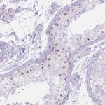 PNMA3 Polyclonal Antibody