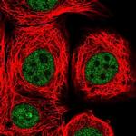 THOC2 Polyclonal Antibody