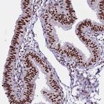 THOC2 Antibody in Immunohistochemistry (Paraffin) (IHC (P))
