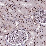 THOC2 Antibody in Immunohistochemistry (Paraffin) (IHC (P))