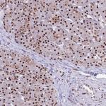 THOC2 Antibody in Immunohistochemistry (Paraffin) (IHC (P))