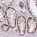 NACC2 Polyclonal Antibody